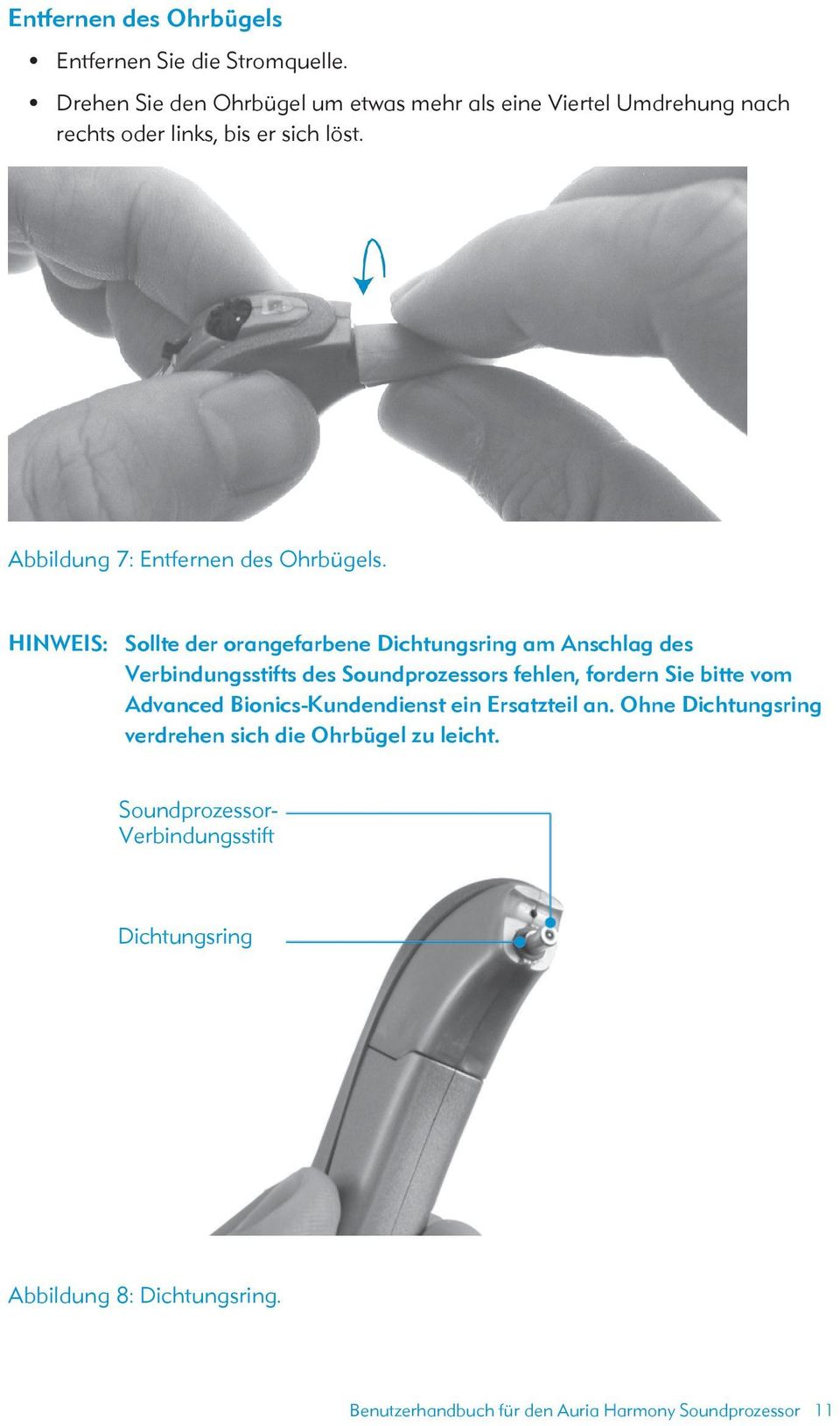 Abbildung 7: Entfernen des Ohrbügels.