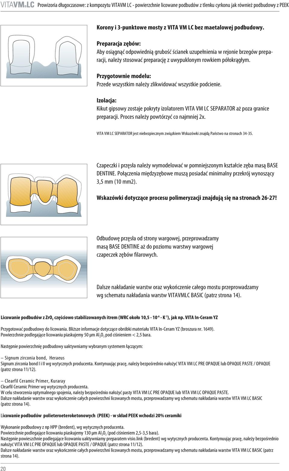 Przygotownie modelu: Przede wszystkim należy zlikwidować wszystkie podcienie. Izolacja: Kikut gipsowy zostaje pokryty izolatorem VITA VM LC SEPARATOR aż poza granice preparacji.