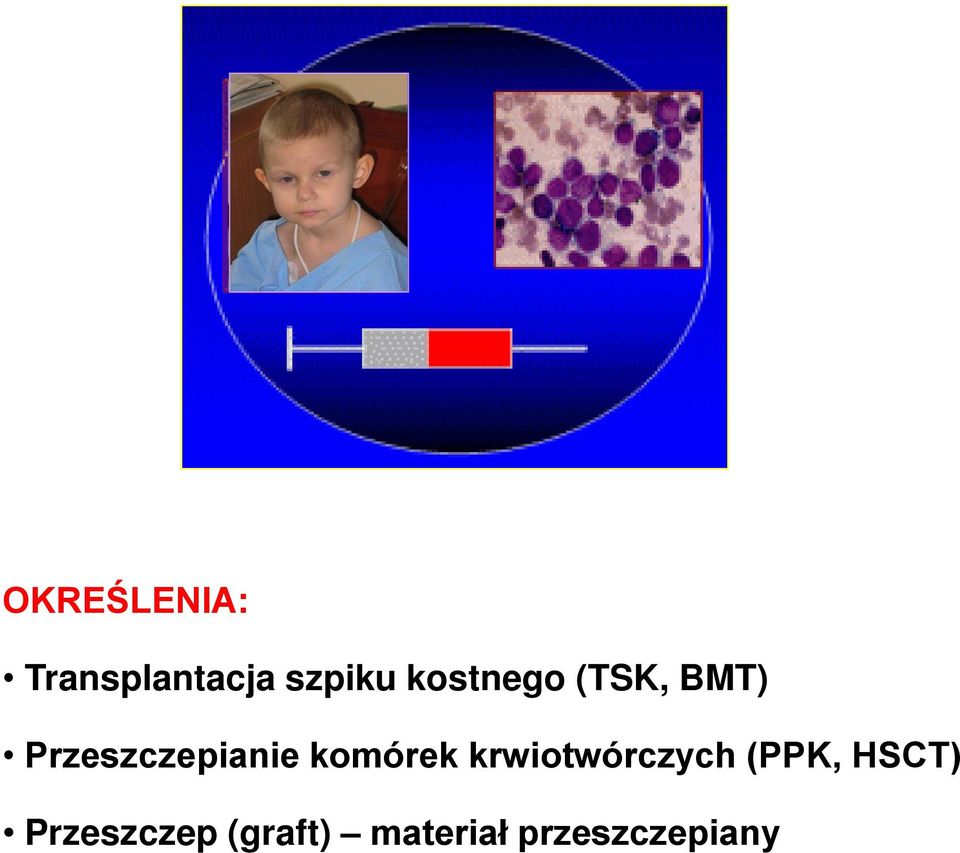 komórek krwiotwórczych (PPK, HSCT)