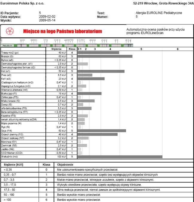 Diagnostyka alergenoswoistych IgE Ocena elektroniczna: skaner, EUROBlotCamera lub EUROBlotOne przy pomocy programu EUROLineScan Inkubacja: maualna (kołyska) lub automatyczna (EUROBlotMaster lub