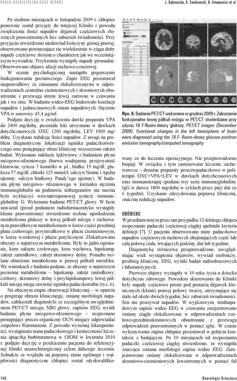 Functional changes in the left hemisphere of brain were diagnosed using the 18 F- fluoro-deoxy glucose positron emission tomography/computed tomography Po siedmiu miesiącach w listopadzie 2009 r.