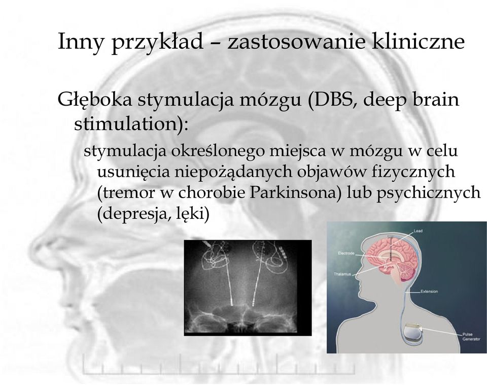 w mózgu w celu usunięcia niepoŝądanych objawów fizycznych