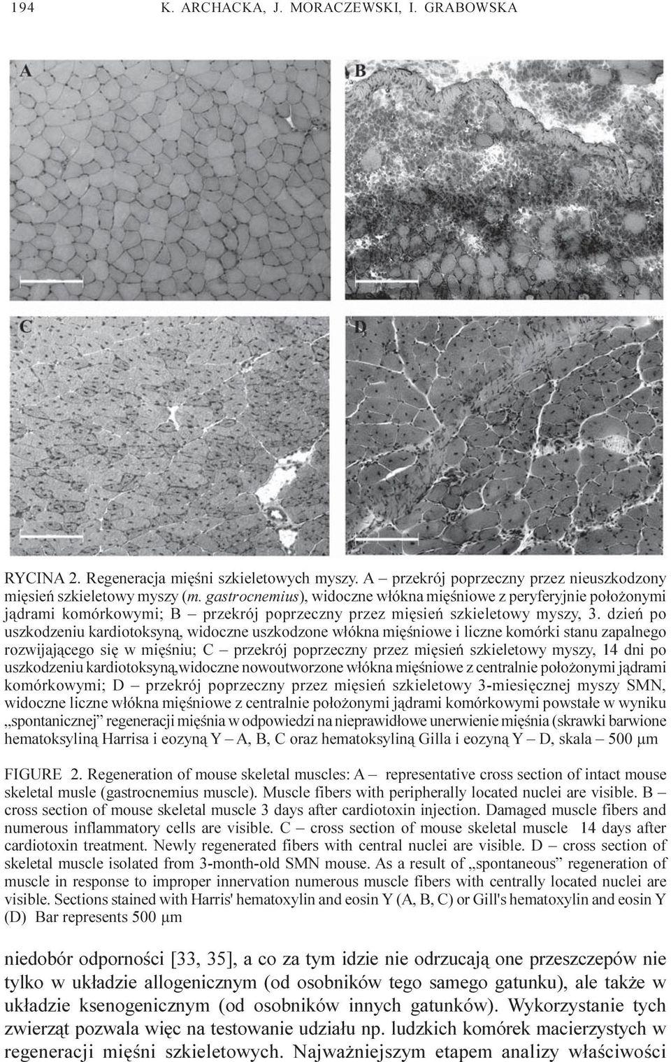 dzieñ po uszkodzeniu kardiotoksyn¹, widoczne uszkodzone w³ókna miêœniowe i liczne komórki stanu zapalnego rozwijaj¹cego siê w miêœniu; C przekrój poprzeczny przez miêsieñ szkieletowy myszy, 14 dni po