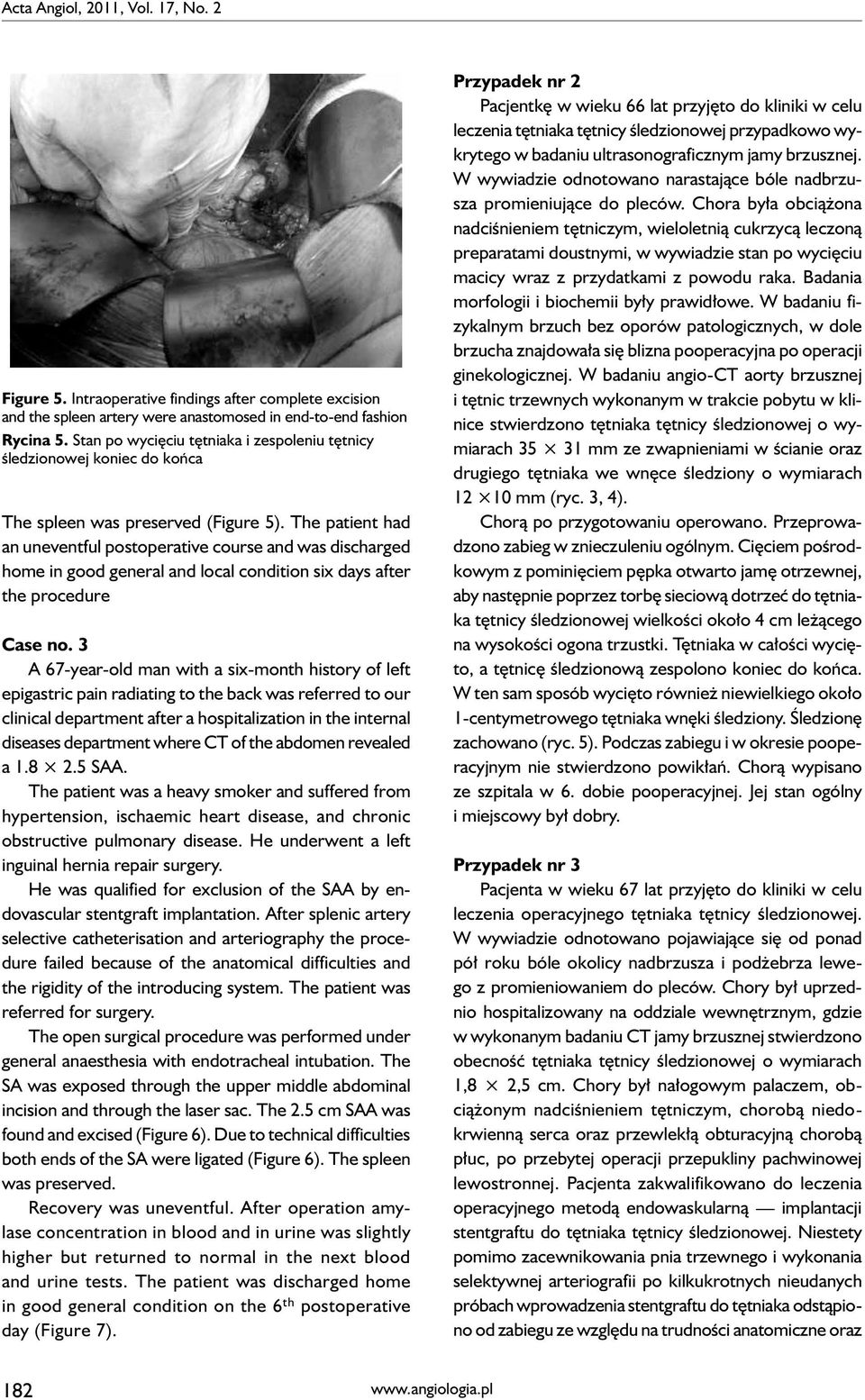 The patient had an uneventful postoperative course and was discharged home in good general and local condition six days after the procedure Case no.