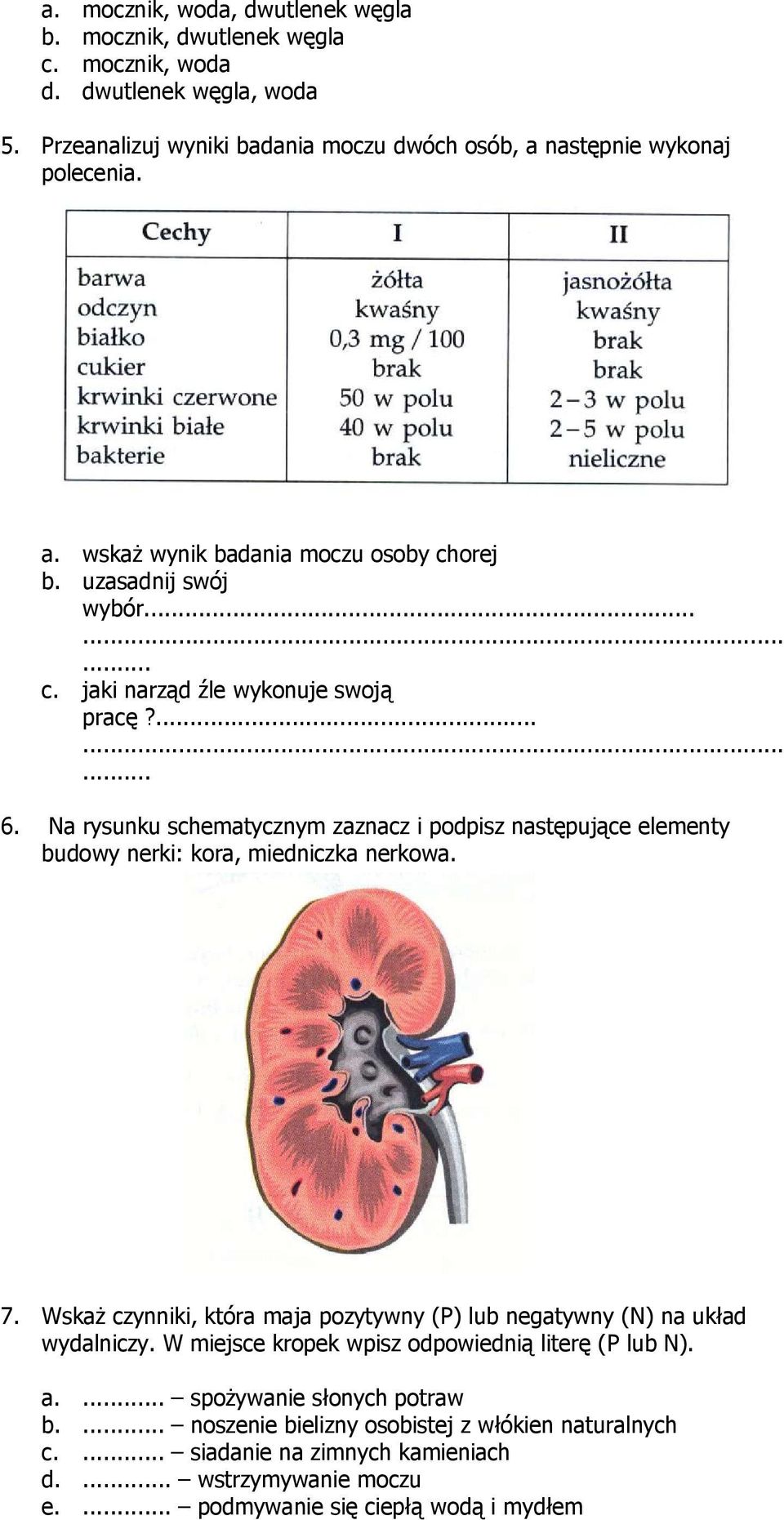 Na rysunku schematycznym zaznacz i podpisz następujące elementy budowy nerki: kora, miedniczka nerkowa. 7.