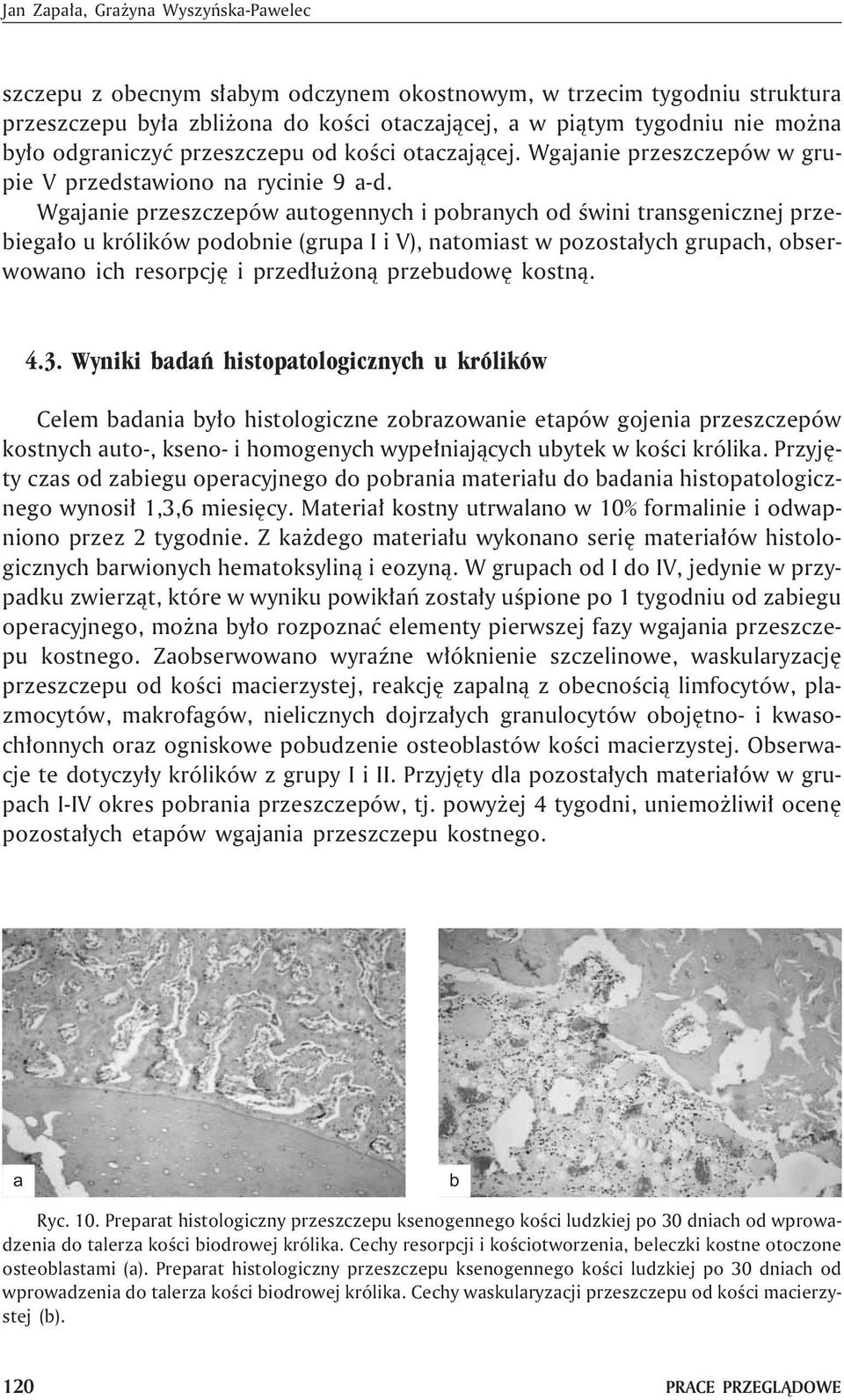 Wgjnie przeszczepów utogennych i pornych od œwini trnsgenicznej przeieg³o u królików podonie (grup I i V), ntomist w pozost³ych grupch, oserwowno ich resorpcjê i przed³u on¹ przeudowê kostn¹. 4.3.