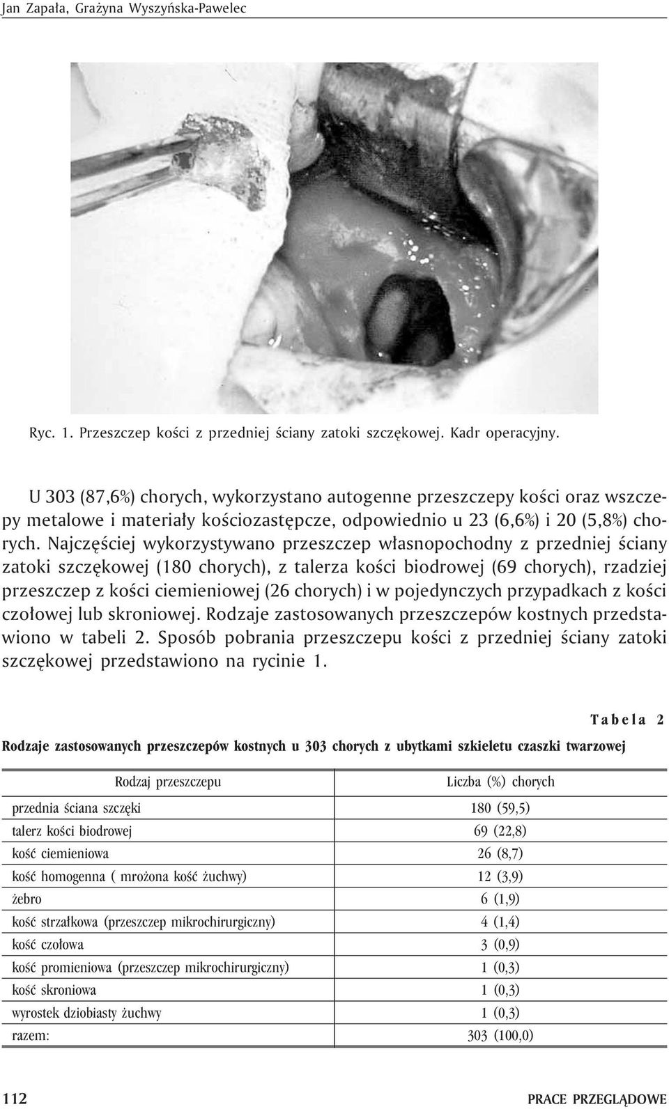 Njczêœciej wykorzystywno przeszczep w³snopochodny z przedniej œciny ztoki szczêkowej (180 chorych), z tlerz koœci iodrowej (69 chorych), rzdziej przeszczep z koœci ciemieniowej (26 chorych) i w