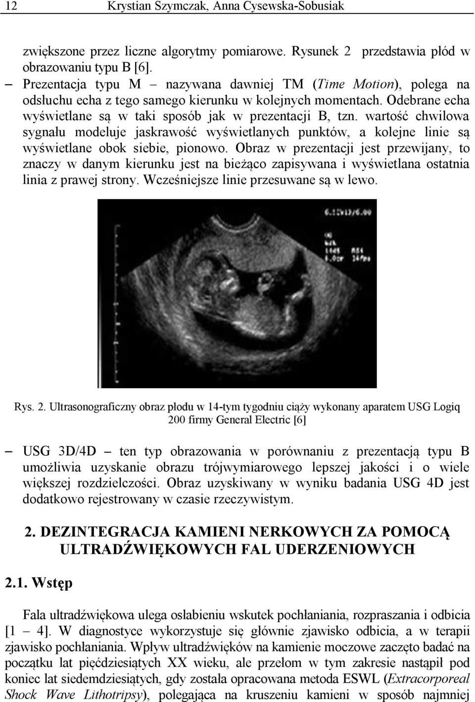 wartość chwilowa sygnału modeluje jaskrawość wyświetlanych punktów, a kolejne linie są wyświetlane obok siebie, pionowo.