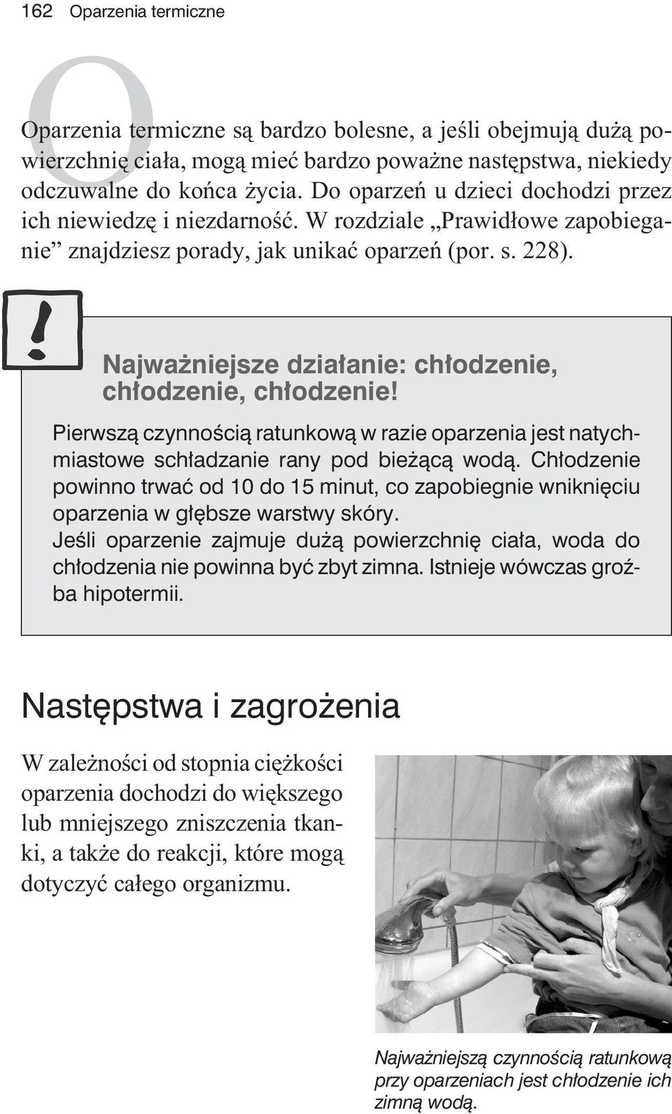 Najwa niejsze dzia³anie: ch³odzenie, ch³odzenie, ch³odzenie! Pierwsz¹ czynnoœci¹ ratunkow¹ w razie oparzenia jest natychmiastowe sch³adzanie rany pod bie ¹c¹ wod¹.