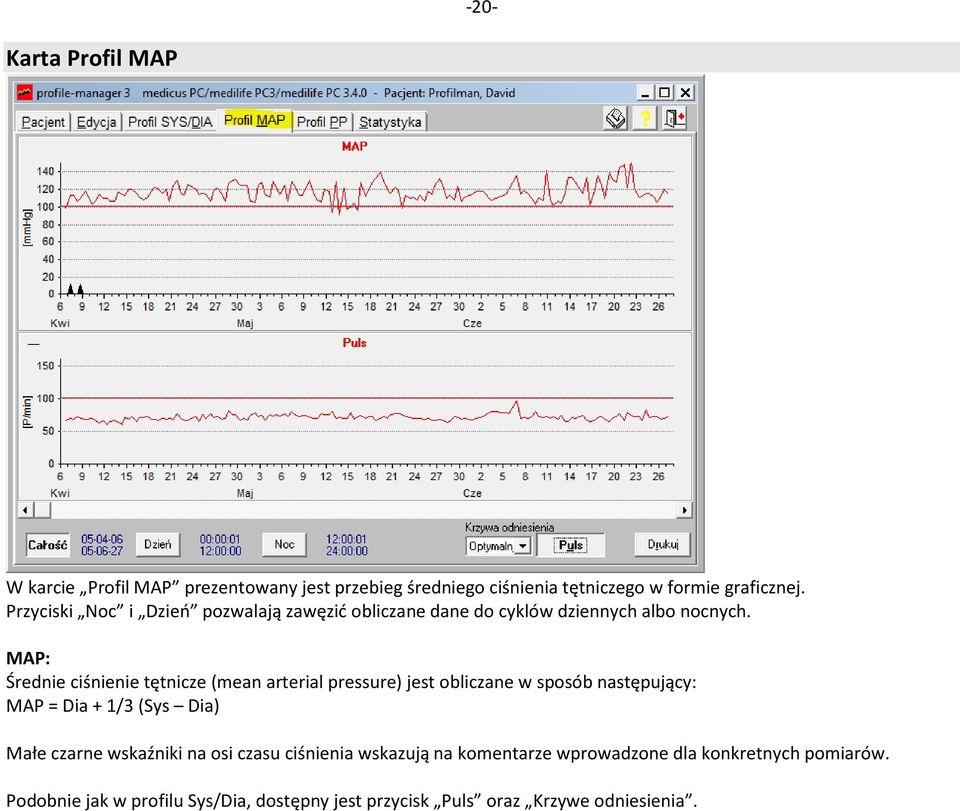 MAP: Średnie ciśnienie tętnicze (mean arterial pressure) jest obliczane w sposób następujący: MAP = Dia + 1/3 (Sys Dia) Małe