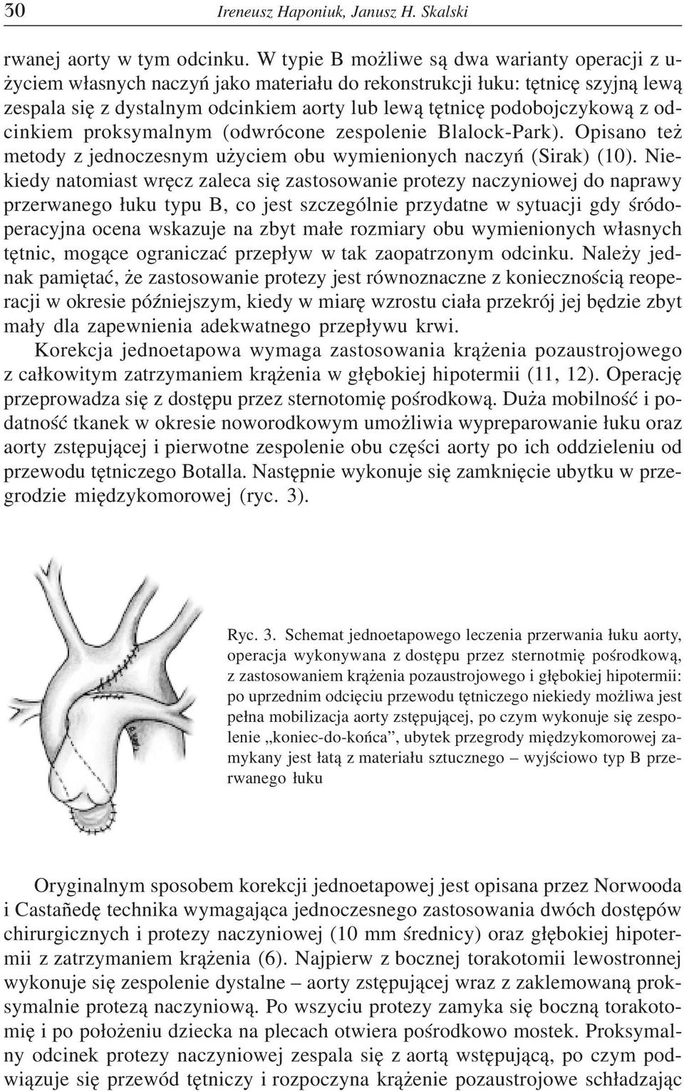 z odcinkiem proksymalnym (odwrócone zespolenie Blalock-Park). Opisano te metody z jednoczesnym u yciem obu wymienionych naczyñ (Sirak) (10).