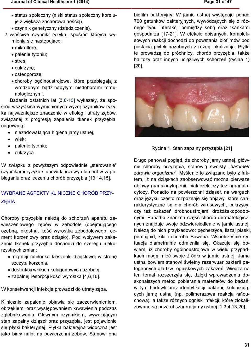 niedoborami immunologicznymi.