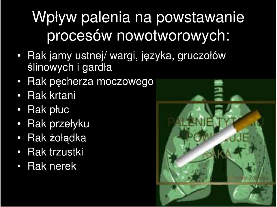 gruczołów ślinowych i gardła Rak pęcherza