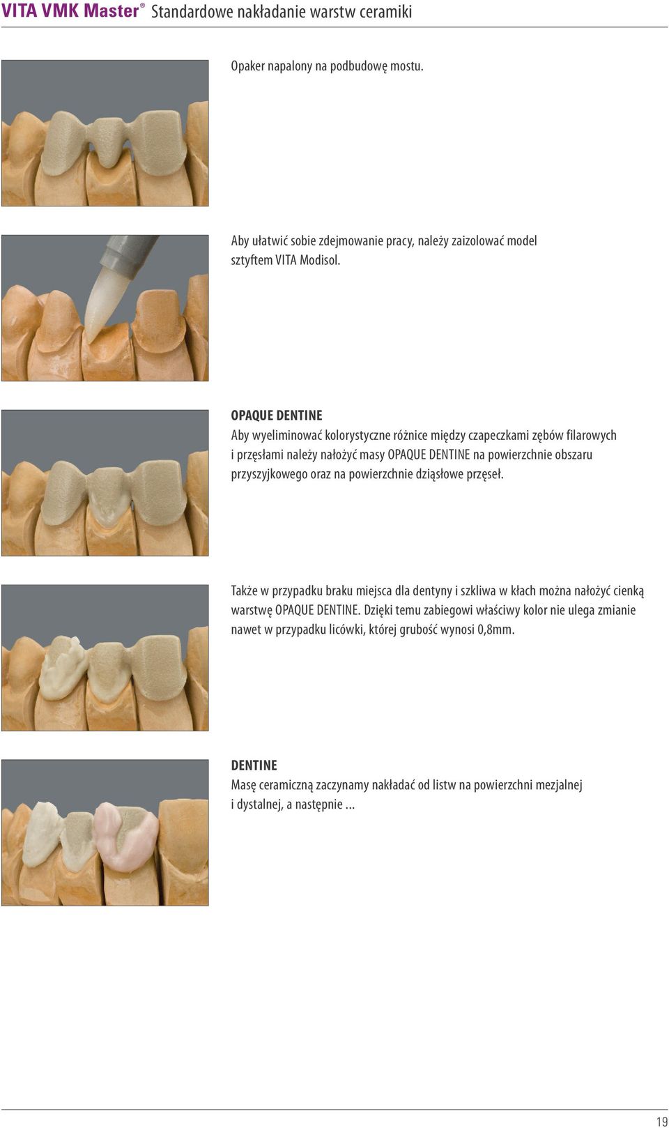 przyszyjkowego oraz na powierzchnie dziąsłowe przęseł. Także w przypadku braku miejsca dla dentyny i szkliwa w kłach można nałożyć cienką warstwę OPAQUE DENTINE.