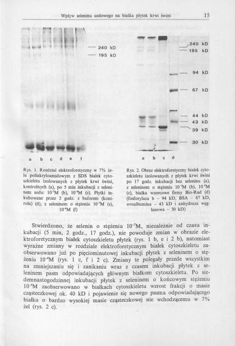 inkubacji bez seleninu (a), z seleninem o stężeniu 10 M (b), 10 4M (c), białka wzorcowe firmy Bio-Rad (d) (fosforylaza b - 94 kd, BSA - 67 kd, ovoalbumina - 43 kd i anhydraza węglanowa - 30 kd)