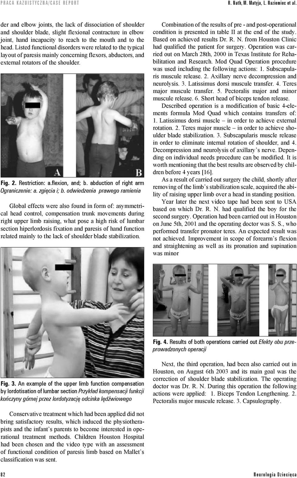 Listed functional disorders were related to the typical layout of paresis mainly concerning flexors, abductors, and external rotators of the shoulder. Fig. 2. Restriction: a.flexion, and; b.