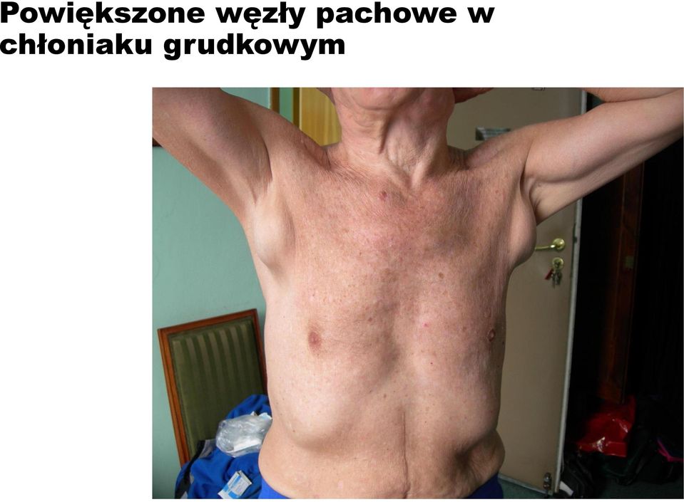 pachowe w