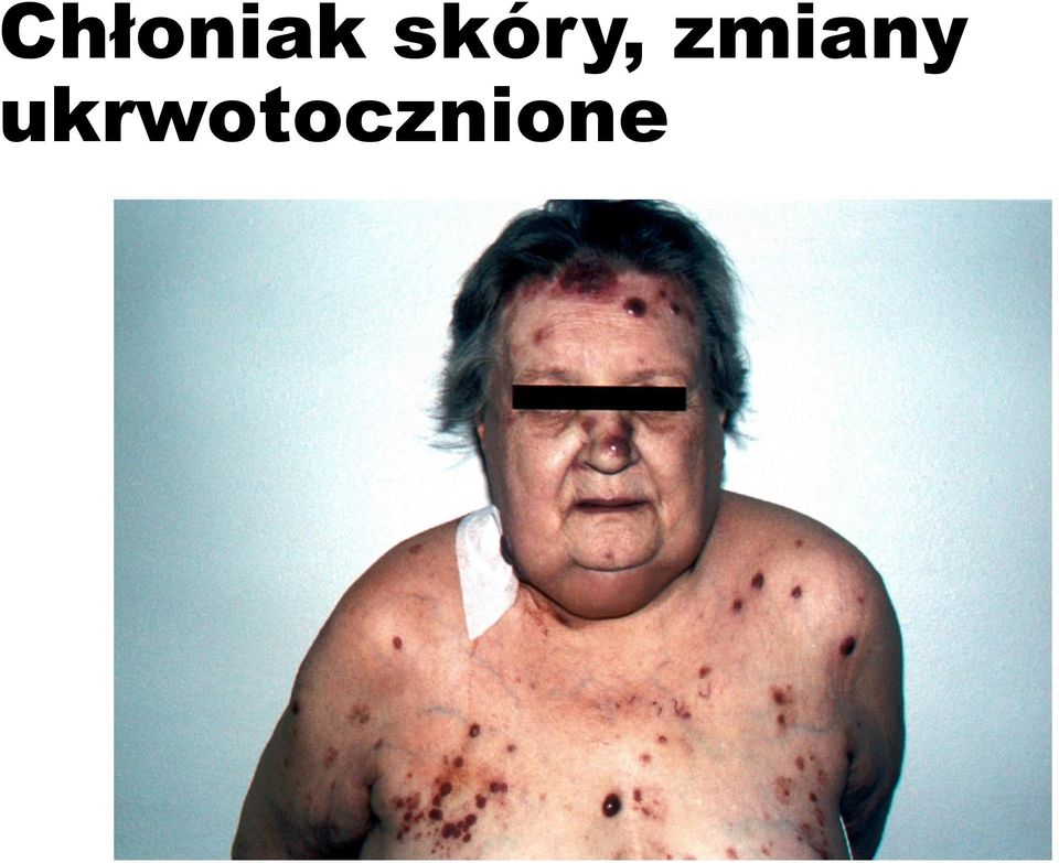 zmiany