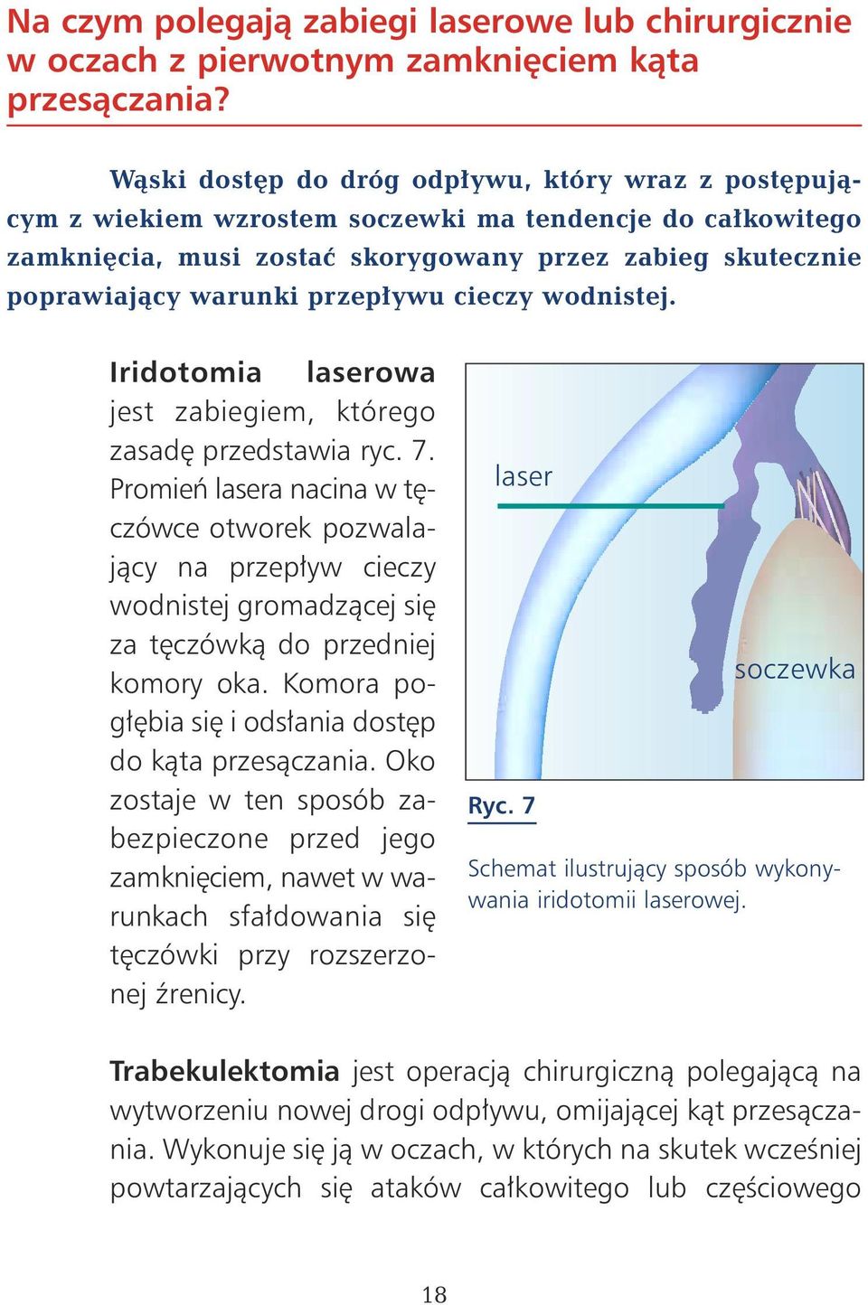 ywu cieczy wodnistej. Iridotomia laserowa jest zabiegiem, którego zasad przedstawia ryc. 7.