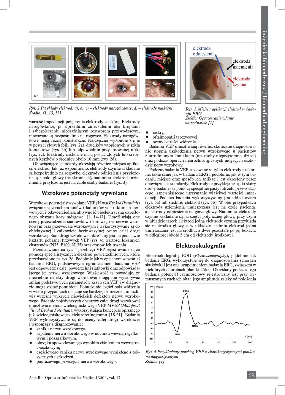 3 Mejsca aplkacj elektrod badanu Źródło: ej elektroretnograf [1, 13, 17] M (Multfocal Electroretnography) Pobudne częśc pola dna ze mogą zostać pomnęte. [11-13].