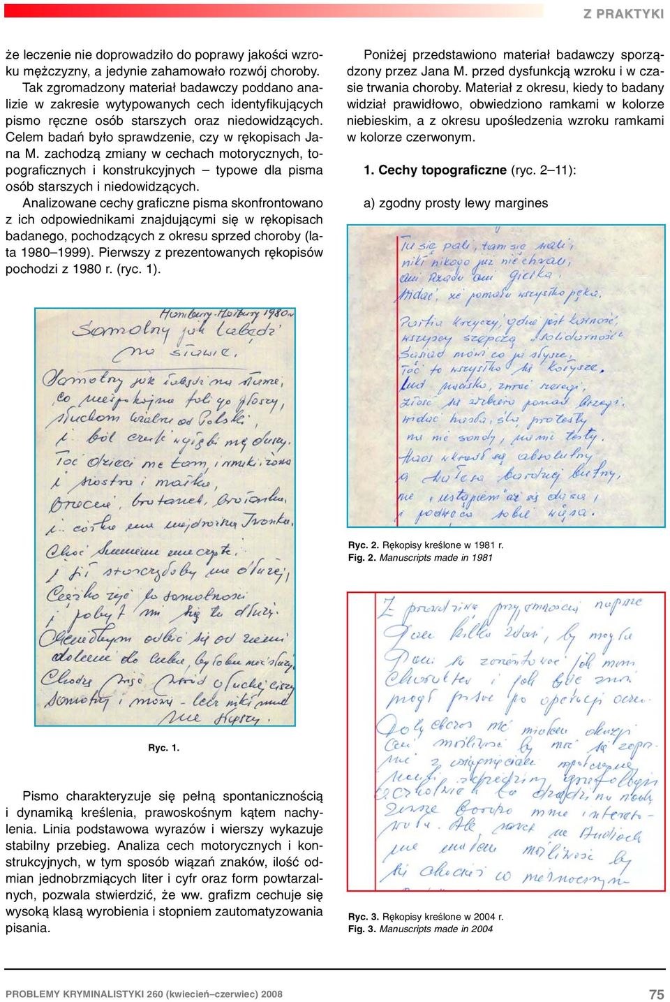 zachodz¹ zmiany w cechach motorycznych, topograficznych i konstrukcyjnych typowe dla pisma osób starszych i niedowidz¹cych.