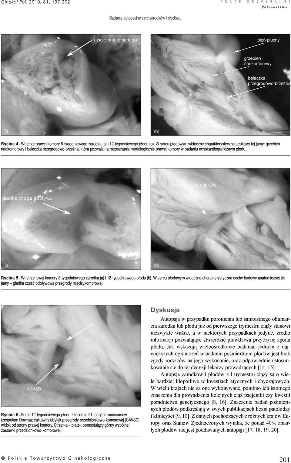 echokardiograficznym płodu. Rycina 5. Wnętrze lewej komory 8-tygodniowego zarodka i 12-tygodniowego płodu.