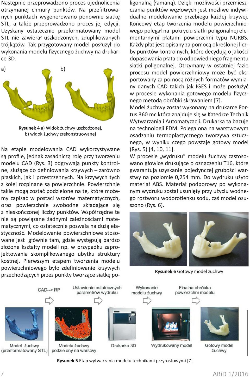 a) b) Rysunek 4 a) Widok żuchwy uszkodzonej, b) widok żuchwy zrekonstruowanej Na etapie modelowania CAD wykorzystywane są profile, jednak zasadniczą rolę przy tworzeniu modelu CAD (Rys.