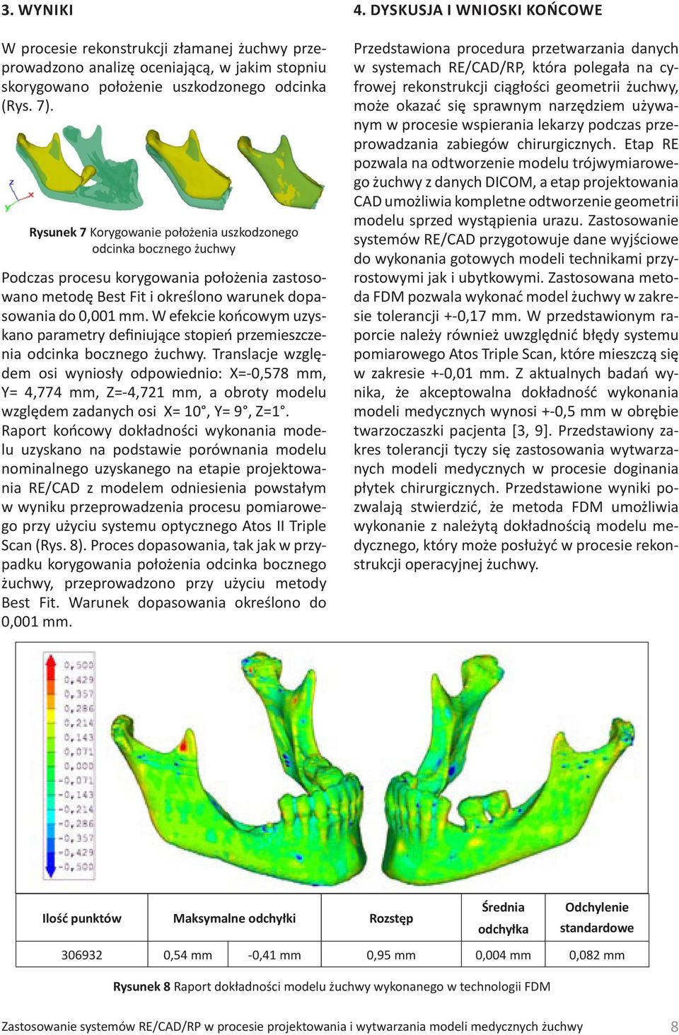 W efekcie końcowym uzyskano parametry definiujące stopień przemieszczenia odcinka bocznego żuchwy.