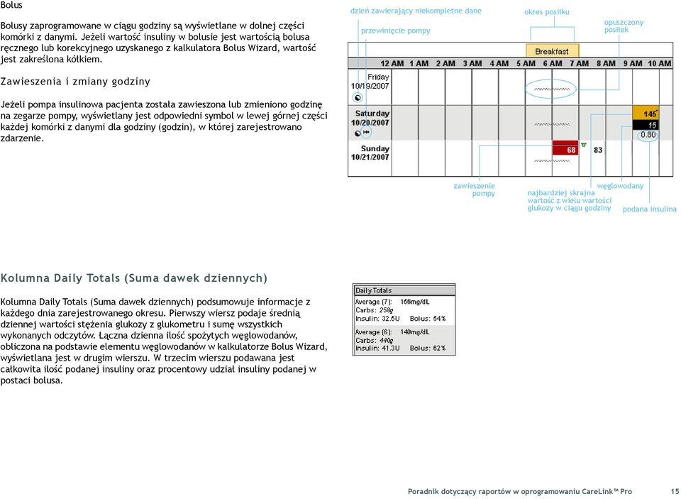 dzień zawierający niekompletne dane przewinięcie pompy okres posiłku opuszczony posiłek Zawieszenia i zmiany godziny Jeżeli pompa insulinowa pacjenta została zawieszona lub zmieniono godzinę na