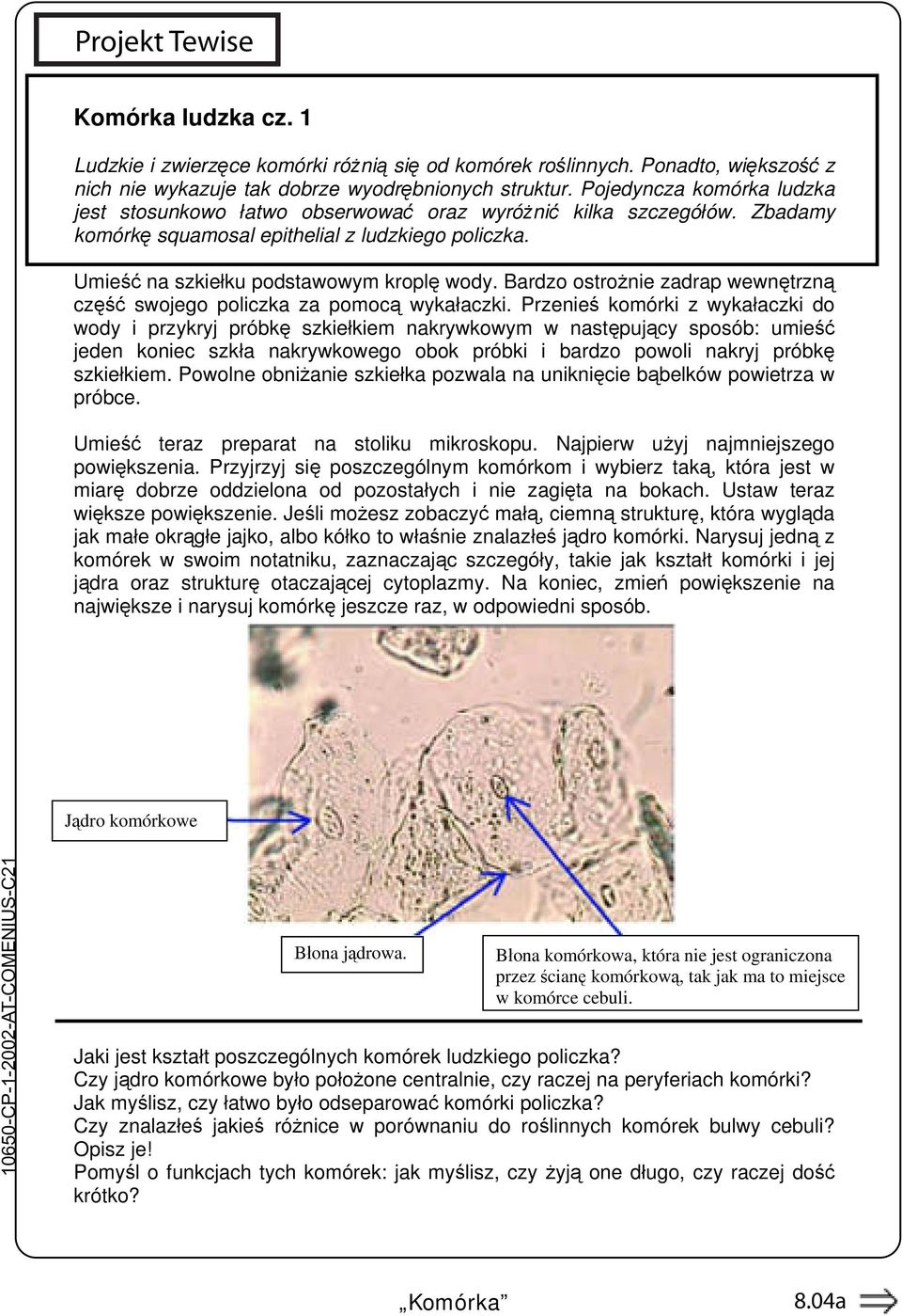 Bardzo ostrożnie zadrap wewnętrzną część swojego policzka za pomocą wykałaczki.