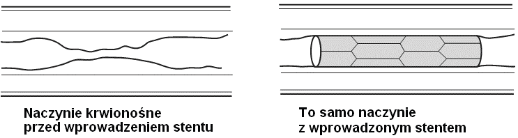 Zadanie 24. (1 pkt). Uporządkuj wymienione rodzaje elementów morfotycznych krwi (krwinek) ze względu na ich liczbę we krwi zdrowego człowieka, począwszy od najliczniejszych.