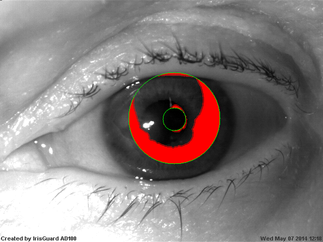 Wpływ chorób oczu Wyniki Re: Pytanie 4 Jakie są przyczyny pogorszenia niezawodności?