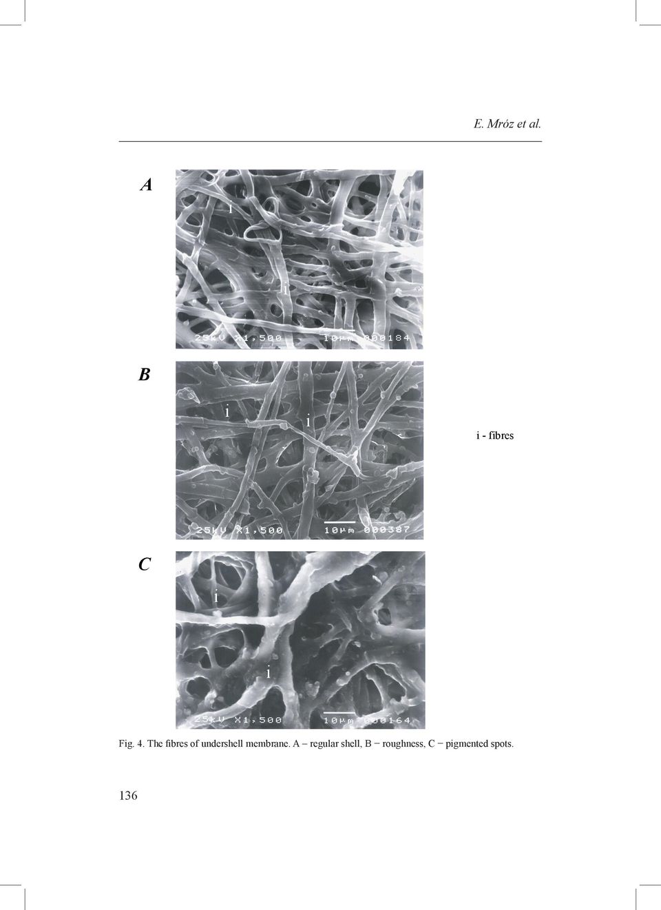 4. The fibres of undershell