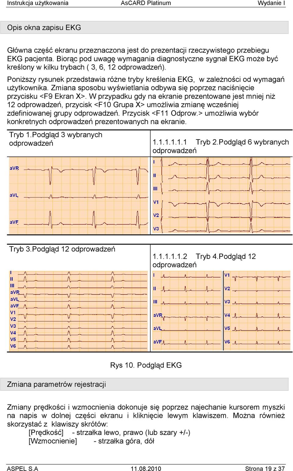 PoniŜszy rysunek przedstawia róŝne tryby kreślenia EKG, w zaleŝności od wymagań uŝytkownika. Zmiana sposobu wyświetlania odbywa się poprzez naciśnięcie przycisku <F9 Ekran X>.