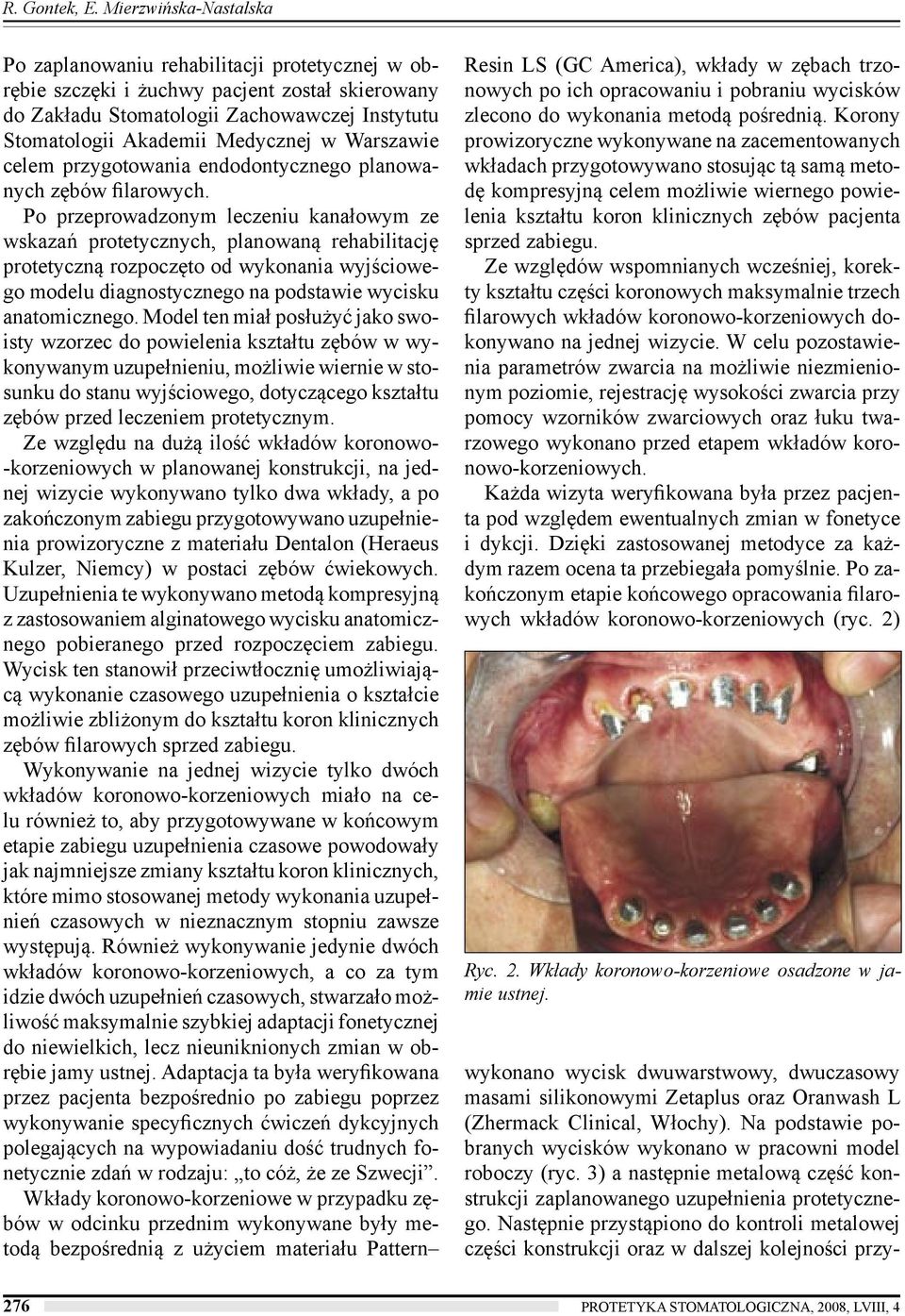 Warszawie celem przygotowania endodontycznego planowanych zębów filarowych.