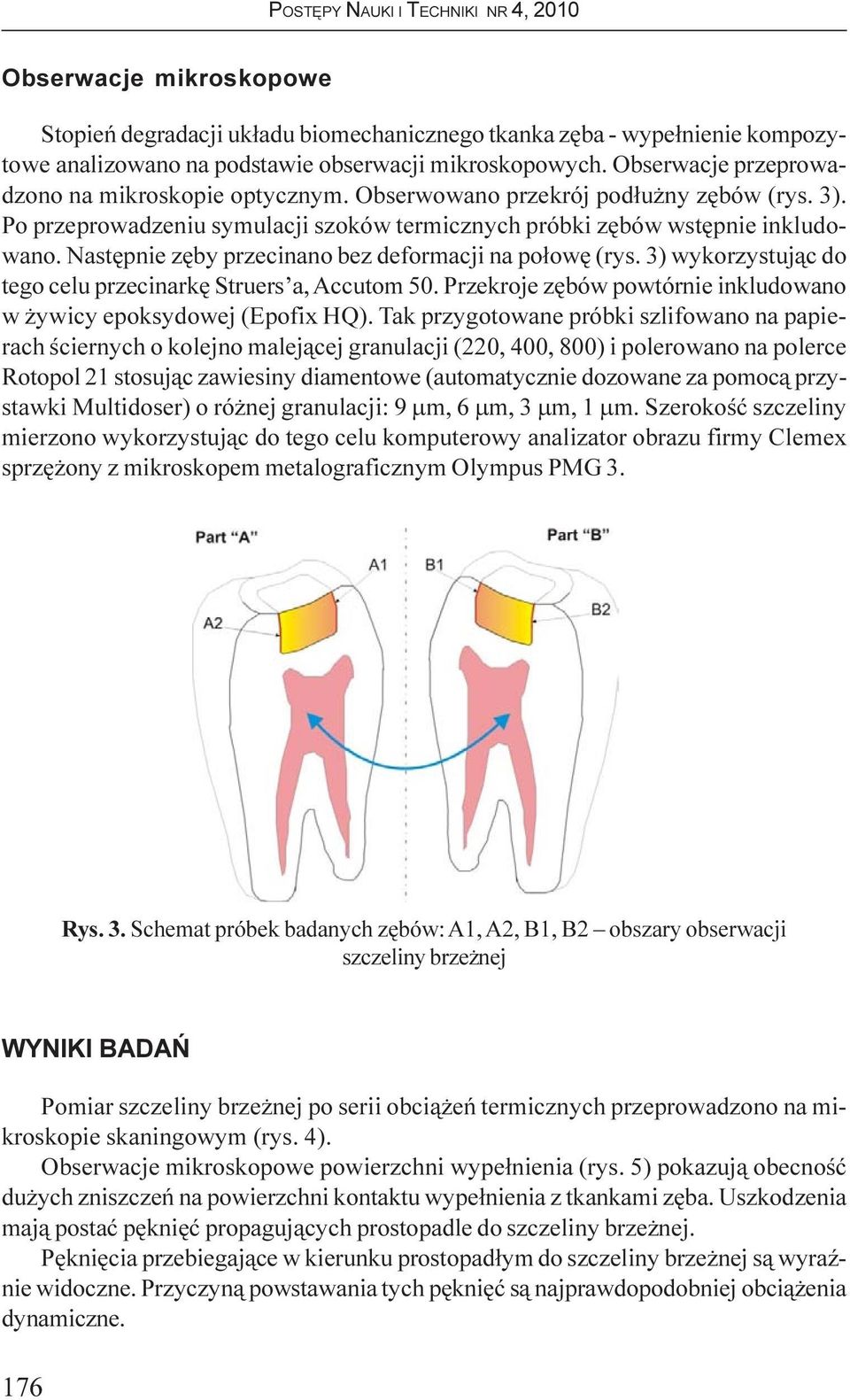 Nastêpnie zêby przecinano bez deformacji na po³owê (rys. 3) wykorzystuj¹c do tego celu przecinarkê Struers a, Accutom 50. Przekroje zêbów powtórnie inkludowano w ywicy epoksydowej (Epofix HQ).