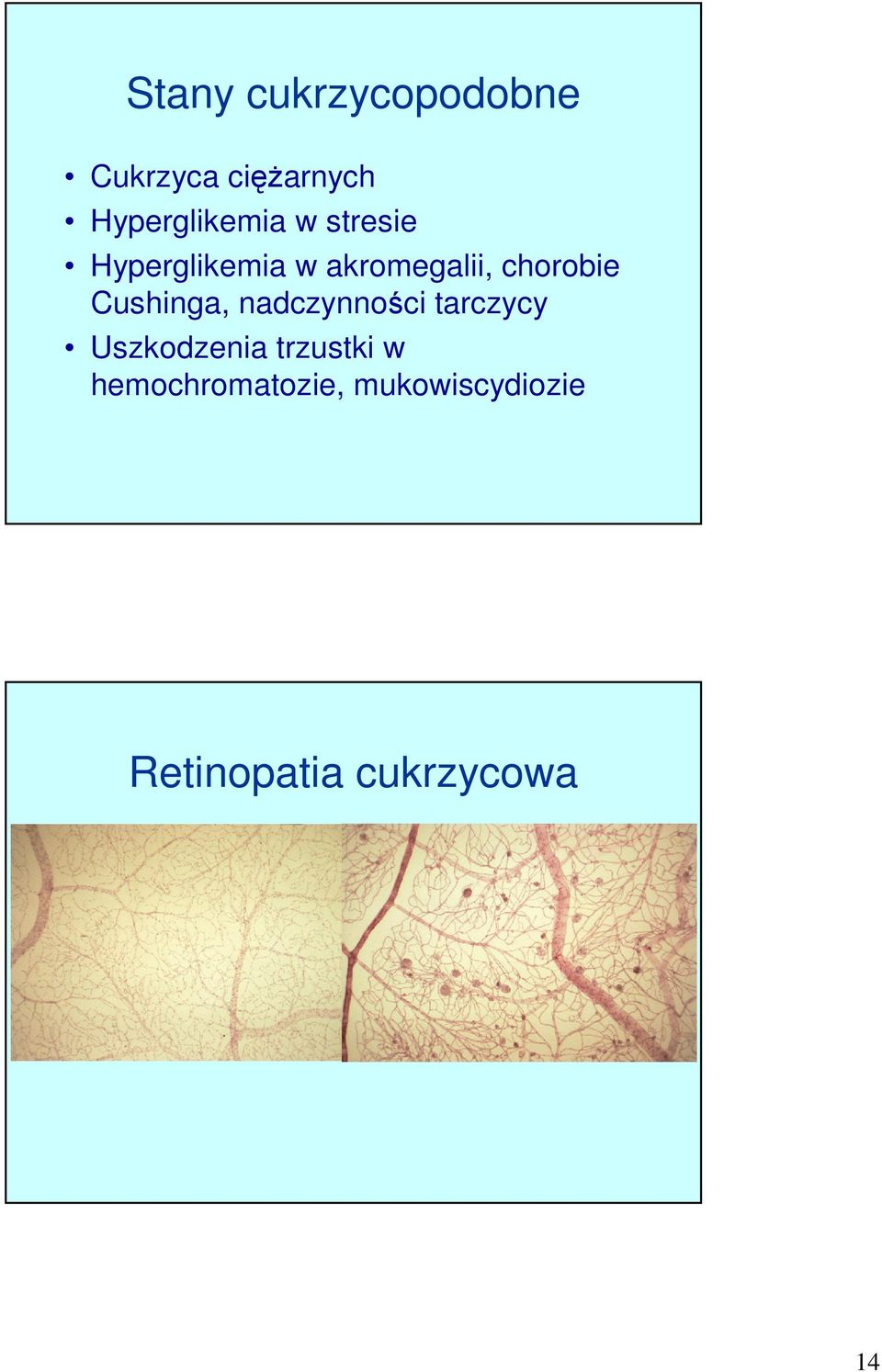 chorobie Cushinga, nadczynności tarczycy Uszkodzenia