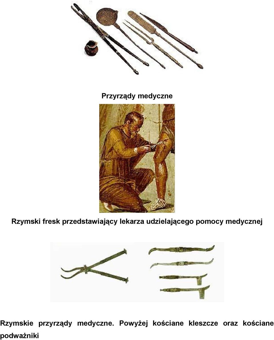 pomocy medycznej Rzymskie przyrządy
