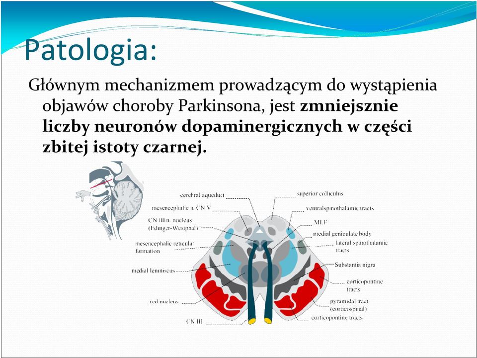 choroby Parkinsona, jest zmniejsznie