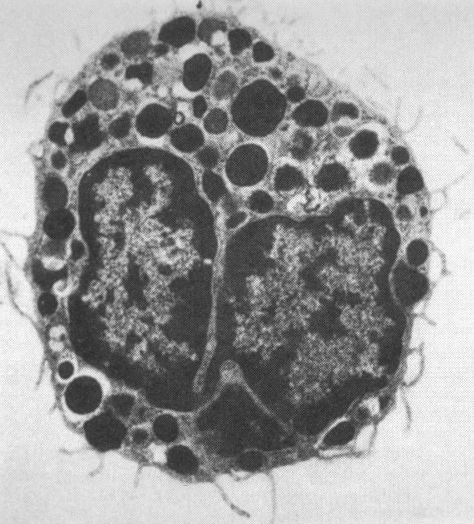 Komórki tuczne (mastocyty)
