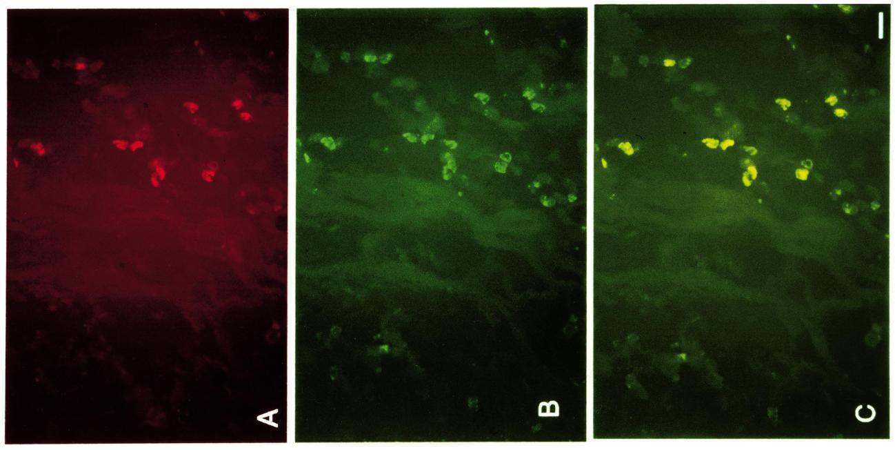 subcutaneous paw tissue. A, B, C: b-endorphin (red).