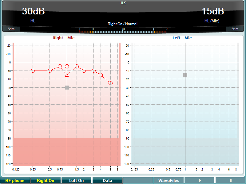 AC40 Brugsanvisning - Dansk Dato: 2012-09-05 Side 27/47 Høretabsimuleringstest HLS simulerer høretab via det audiometriske headset eller højfrekvens-headsettet og er primært rettet mod