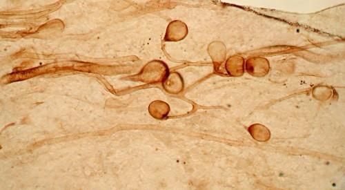 MIKORYZA od wyjścia na ląd Glomus Zygomycetes Glomites mycorrhiza psylofitów 410 mln lat grzyby przyspieszają rozkład detrytusu roślinnego zarodnik korzystają z cukrów