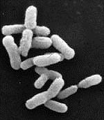 BRODAWKI korzeniowe Frankia Actinomycetes bakterie mają zdolność wiązania azotu atmosferycznego ale tylko w środowisku beztlenowym brodawki gramdodatnie Rhizobium z