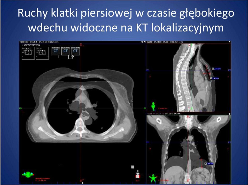 głębokiego wdechu