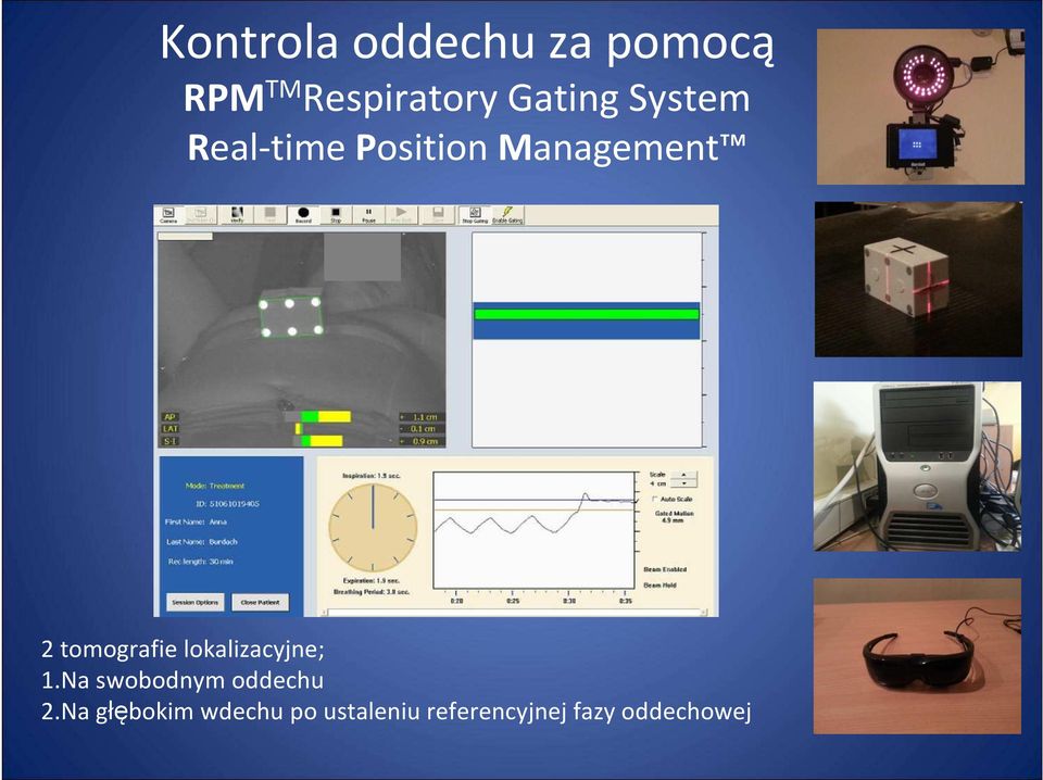 tomografie lokalizacyjne; 1.Na swobodnym oddechu 2.