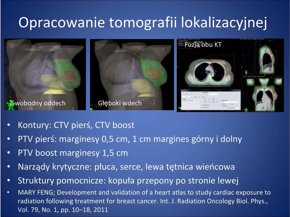 wieńcowa Struktury pomocnicze: kopuła przepony po stronie lewej MARY FENG;Development and validation of a heart atlas to study