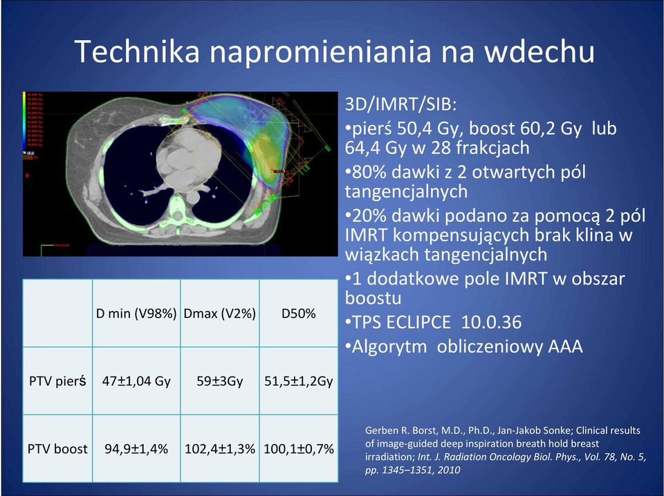 0.36 Algorytm obliczeniowy AAA PTV pierś 47±1,04 Gy 59±3Gy 51,5±1,2Gy PTV boost 94,9±1,4% 102,4±1,3% 100,1±0,7% Gerben R. Borst, M.D.