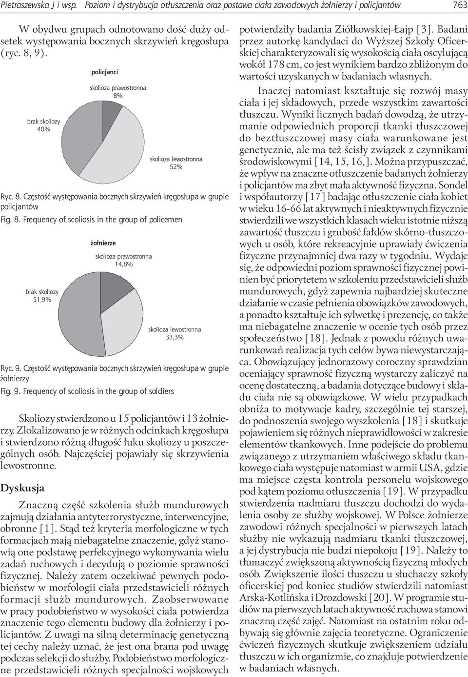 brak skoliozy 40% skolioza prawostronna 8% skolioza lewostronna 52% Ryc. 8. Częstość występowania bocznych skrzywień kręgosłupa w grupie policjantów Fig. 8. Frequency of scoliosis in the group of policemen brak skoliozy 51,9% skolioza prawostronna 14,8% skolioza lewostronna 33,3% Ryc.