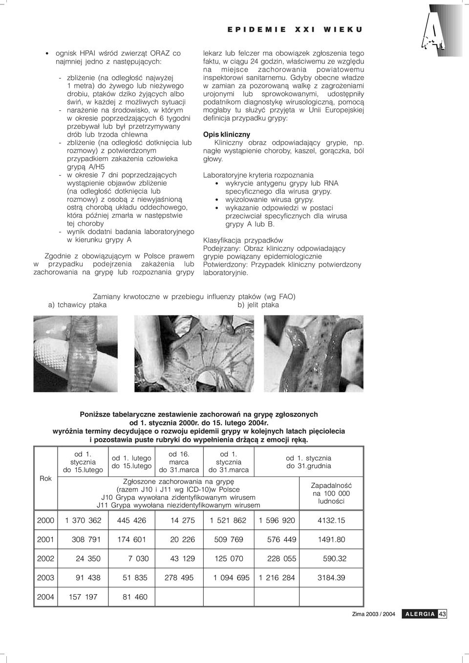 potwierdzonym przypadkiem zaka enia cz³owieka gryp¹ A/H5 - w okresie 7 dni poprzedzaj¹cych wyst¹pienie objawów zbli enie (na odleg³oœæ dotkniêcia lub rozmowy) z osob¹ z niewyjaœnion¹ ostr¹ chorob¹